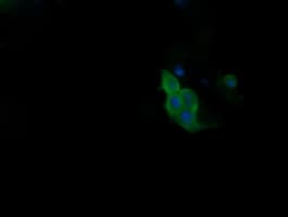 Monoclonal Mouse anti-Human PIK3R5 Antibody (clone OTI4G9, IHC, IF, WB)