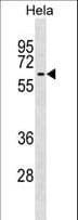 Polyclonal Rabbit anti-Human KLHL12 Antibody (aa376-404, WB)