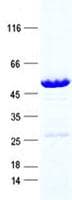 Human SERTAD3 Protein (Recombinant GST, N-terminus + His, C-terminus)