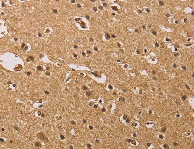 Polyclonal Rabbit anti-Human PRDM14 Antibody (IHC)