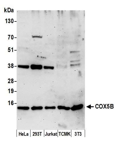 COX5B Antibody (aa25-75)