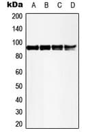 Polyclonal Rabbit anti-Human RPS6KA5 / MSK1 Antibody (phospho-Thr581, WB)