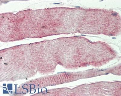IHC-plus™ MAP3K7 / TAK1 Antibody (aa411-460)