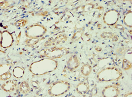 APOL1 / Apolipoprotein L Antibody (aa179-398)