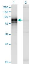 HHIP / HIP Antibody (clone 5D11)