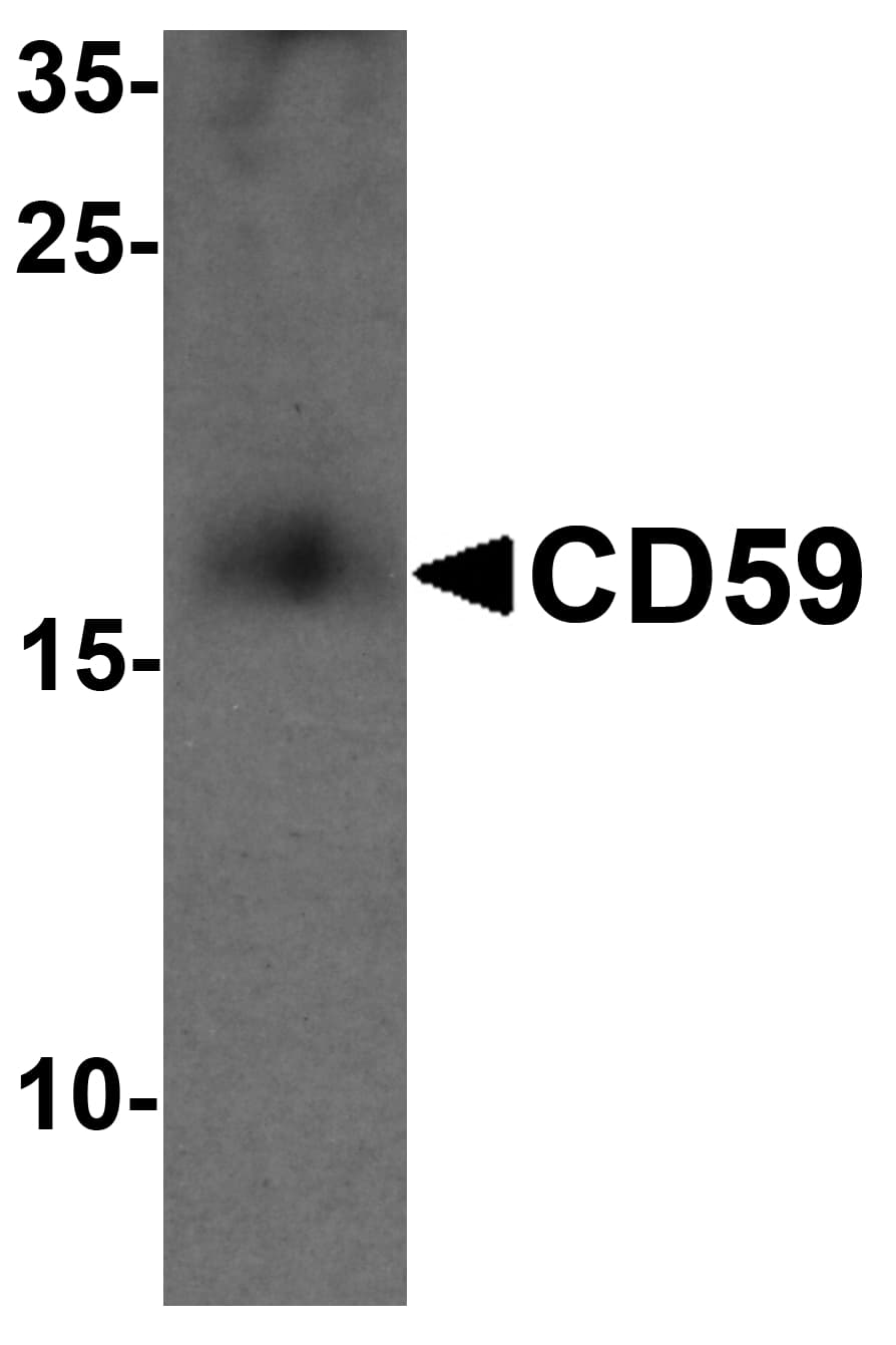 Polyclonal Rabbit anti-Human CD59 Antibody (IHC, WB)