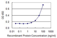 BAZ2B Antibody (clone 2D10)