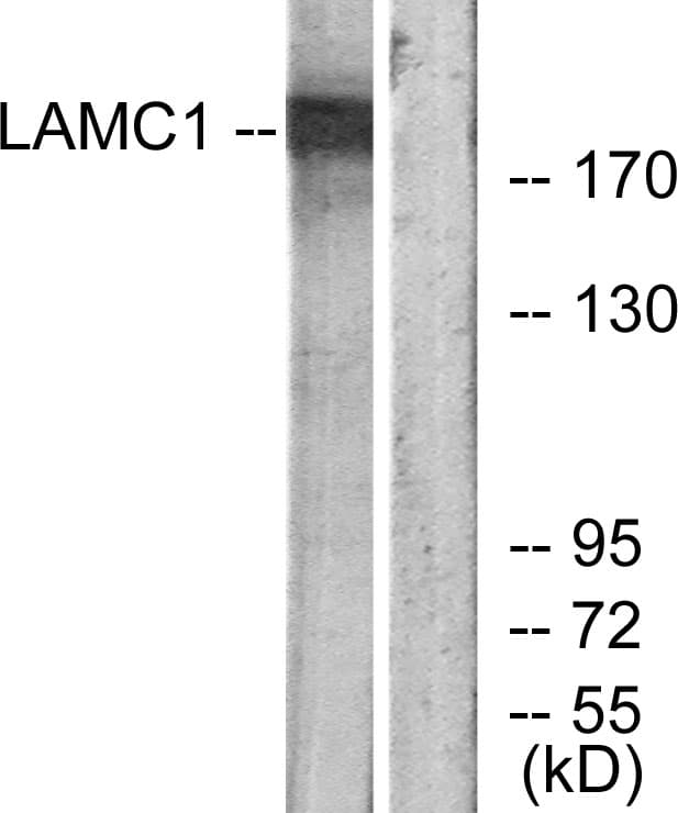 LAMC1 / Laminin Gamma 1 Antibody (aa1451-1500)
