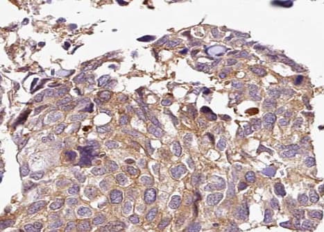 HDAC5 Antibody (phospho-Ser498)