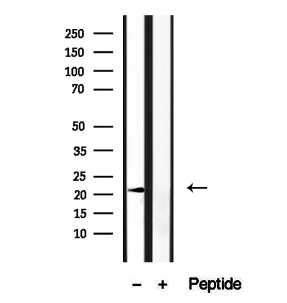ARL6 Antibody