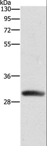 DCK / Deoxycytidine kinase Antibody