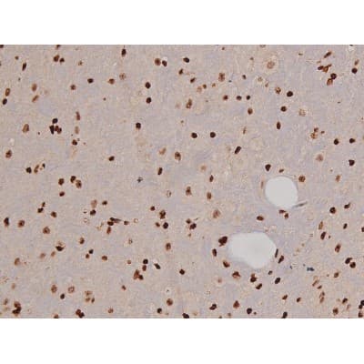 FAK / Focal Adhesion Kinase Antibody (phospho-Tyr397)