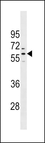 PRAMEF1 Antibody (aa427-454)