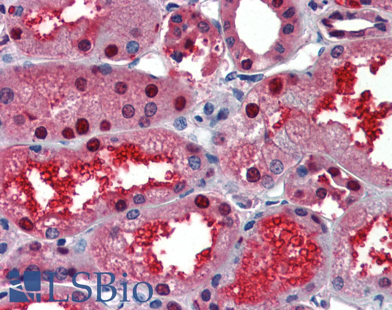L3 / LASS2 Antibody (aa72-121)