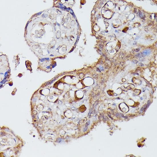 AGT / Angiotensinogen Antibody