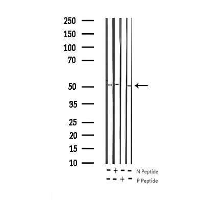 AML1 / RUNX1 Antibody (phospho-Ser303)