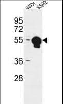 Polyclonal Rabbit anti-Human ATP6V1B1 Antibody (aa284-310, IHC, IF, WB)