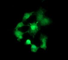 BBOX1 / BBOX Antibody (clone OTI2C8)