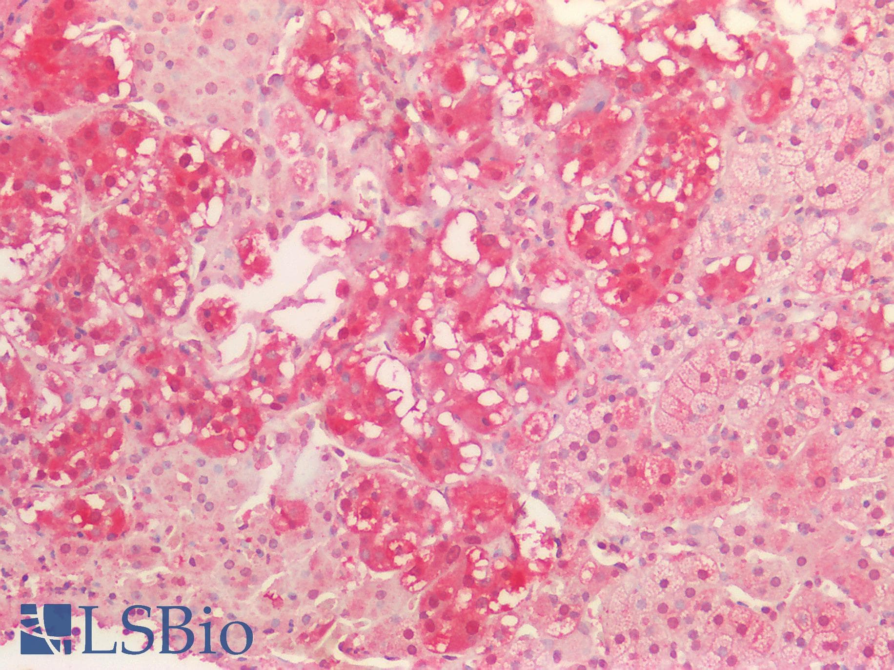 IHC-plus™ STUB1 / CHIP Antibody