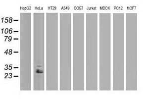 Monoclonal Mouse anti-Human EIF4E2 / IF4e Antibody (clone OTI1F2, IHC, WB)