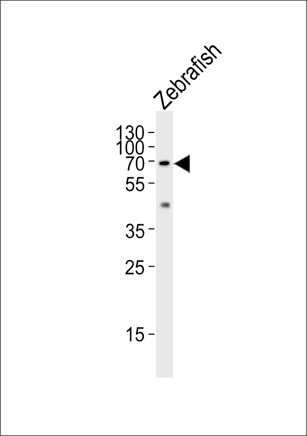 LCP1 / L-Plastin Antibody (aa138-172)