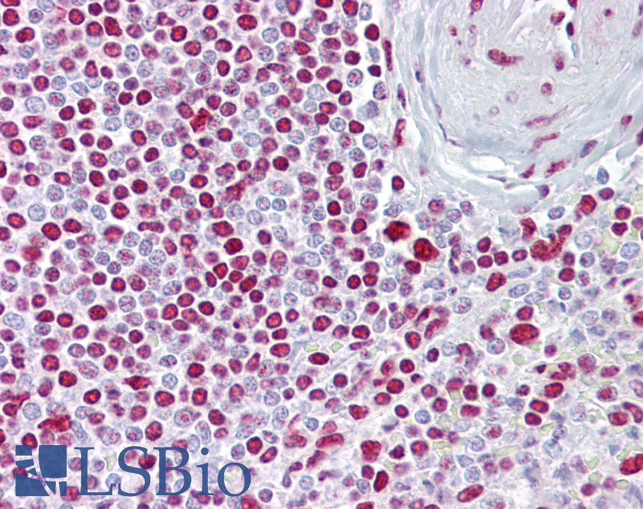 Polyclonal Rabbit anti-Human ATOH1 / MATH-1 Antibody (C-Terminus, IHC, WB)