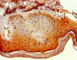 POLR1D Antibody (aa1-133)