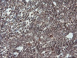 TPRKB Antibody (clone OTI3H3)