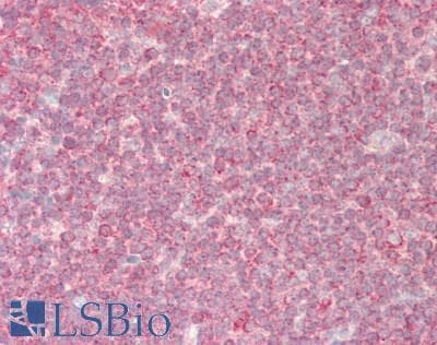 IHC-plus™ GOK / STIM1 Antibody (aa550-600)