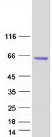 Human ADD2 Protein (Recombinant Myc-DDK (Flag))