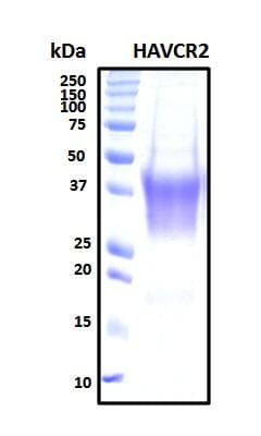 Human HAVCR2 / TIM-3 Protein (Recombinant His, N-Terminal)