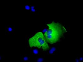 ERIC-1 / TACC3 Antibody (clone OTI1E8)
