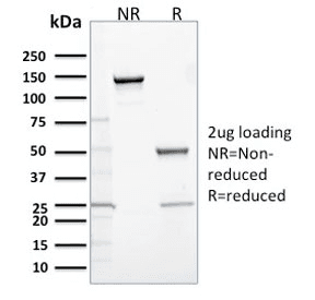 CALB2 / Calretinin Antibody (clone CALB2/2685, Ready-to-Use)
