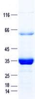 Human MT1M Protein (Recombinant GST, N-terminus + His, C-terminus)