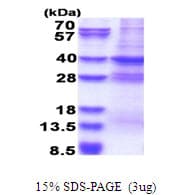 Human MED27 / CRSP8 Protein (Recombinant His)