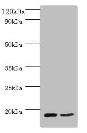 IHC-plus™ CD59 Antibody (aa26-102)