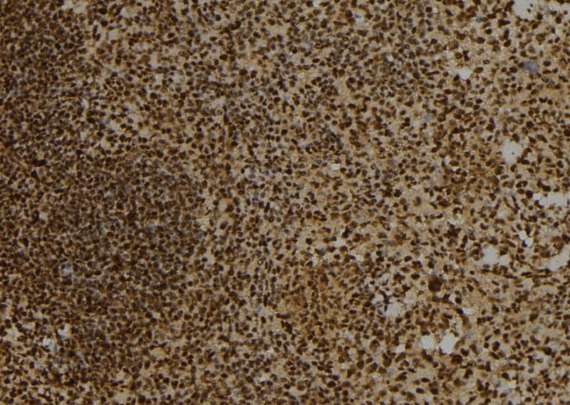 DTNBP1 / Dysbindin Antibody