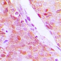 Polyclonal Rabbit anti-Human RPL5 / Ribosomal Protein L5 Antibody (Internal, IHC, WB)