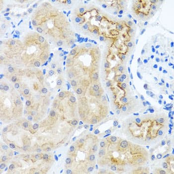 RPS2 / Ribosomal Protein S2 Antibody