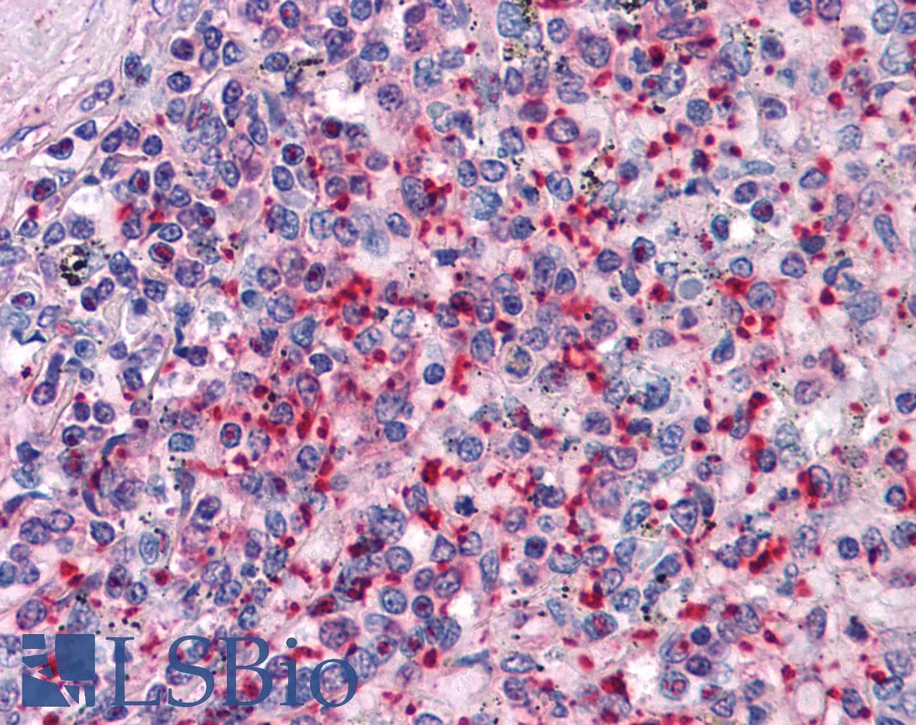 IHC-plus™ TLN1 / Talin 1 Antibody (clone 1A11)