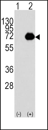 Polyclonal Rabbit anti-Human ACOX1 / ACOX Antibody (aa629-659, WB)