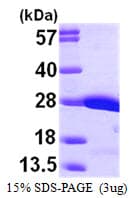 Human CRK Protein (Recombinant His)
