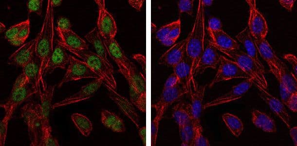 Monoclonal Mouse anti-Human CCT2 / CCT Beta Antibody (clone 5B5C4, IF, WB)