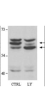 Polyclonal Rabbit anti-Human AKT2 Antibody (aa450-475, WB)