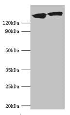 Polyclonal Rabbit anti-Human DCTN1 / Dynactin 1 Antibody (aa1084-1278, IHC, WB)