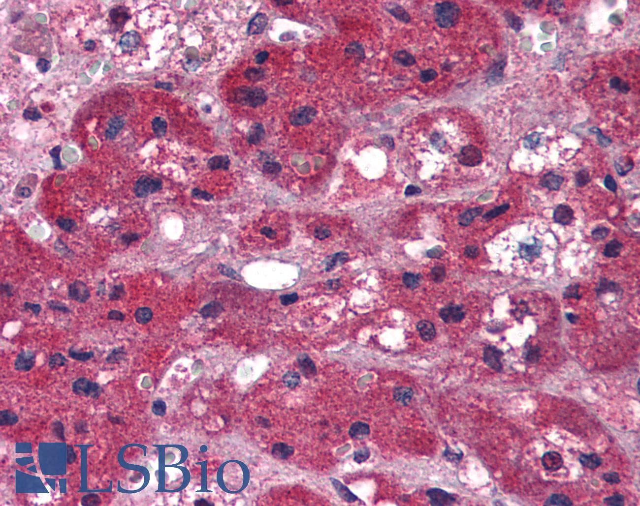 IHC-plus™ ARIH1 Antibody (aa513-526)