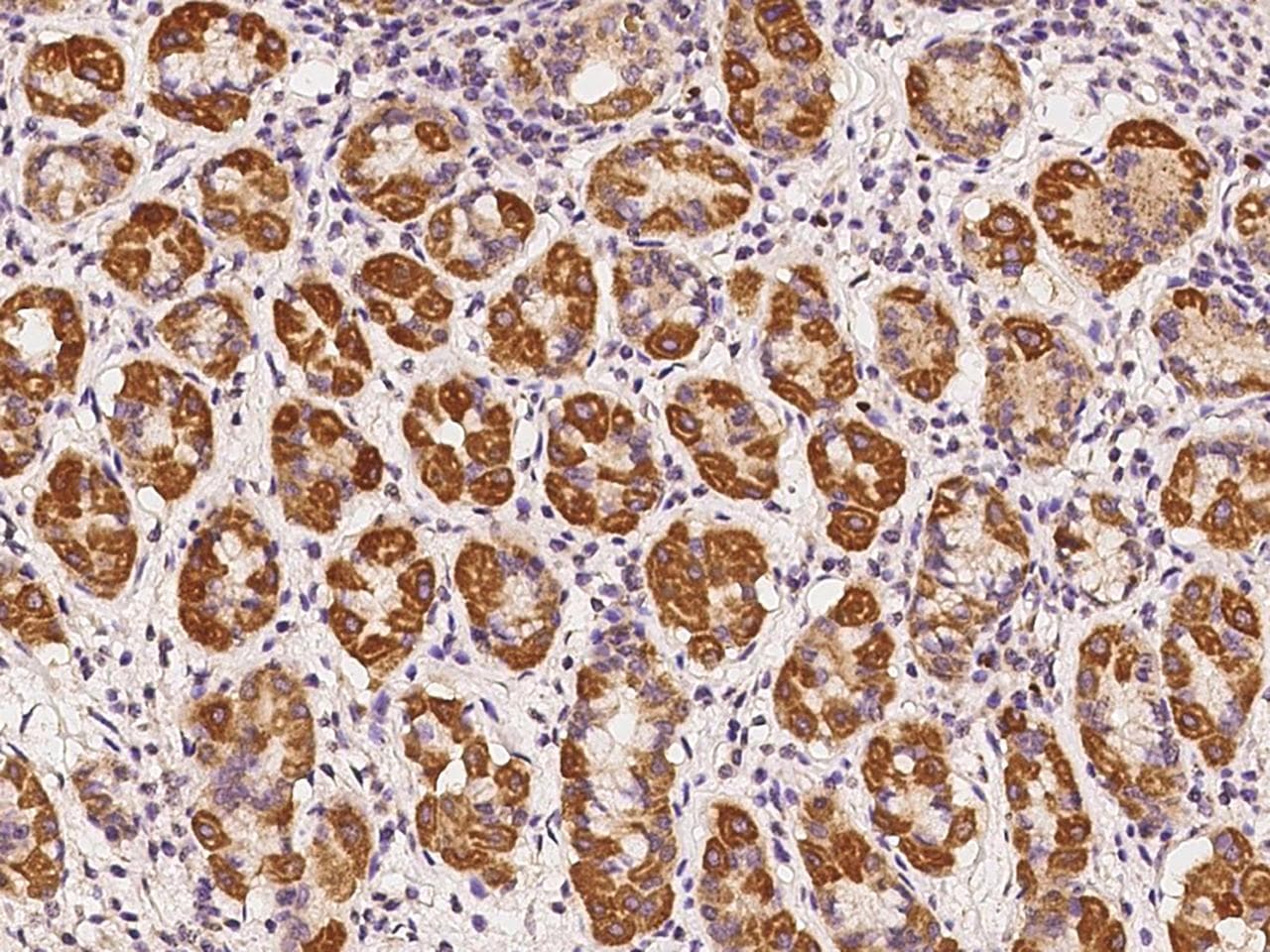 RABGGTA Antibody