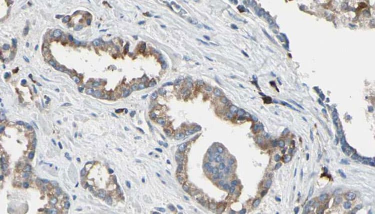 DCT / Dopachrome Tautomerase Antibody