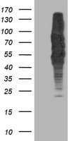 DLD / Diaphorase / E3 Antibody (clone OTI4E11)