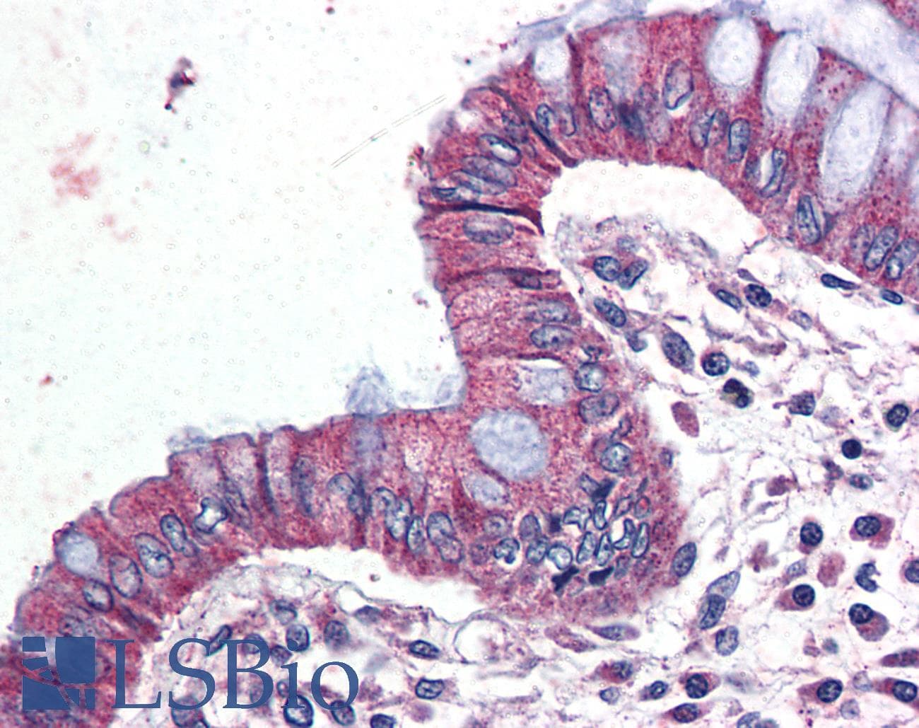 IHC-plus™ ADGRF5 / GPR116 Antibody (Internal)